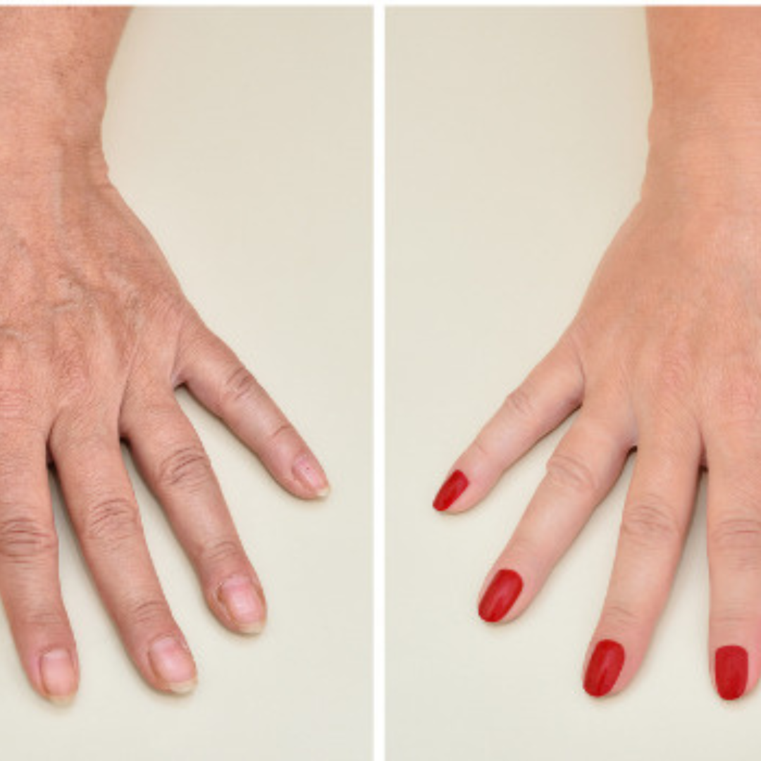 How to Rejuvenate Old and Mature-Looking Hands with Exercise