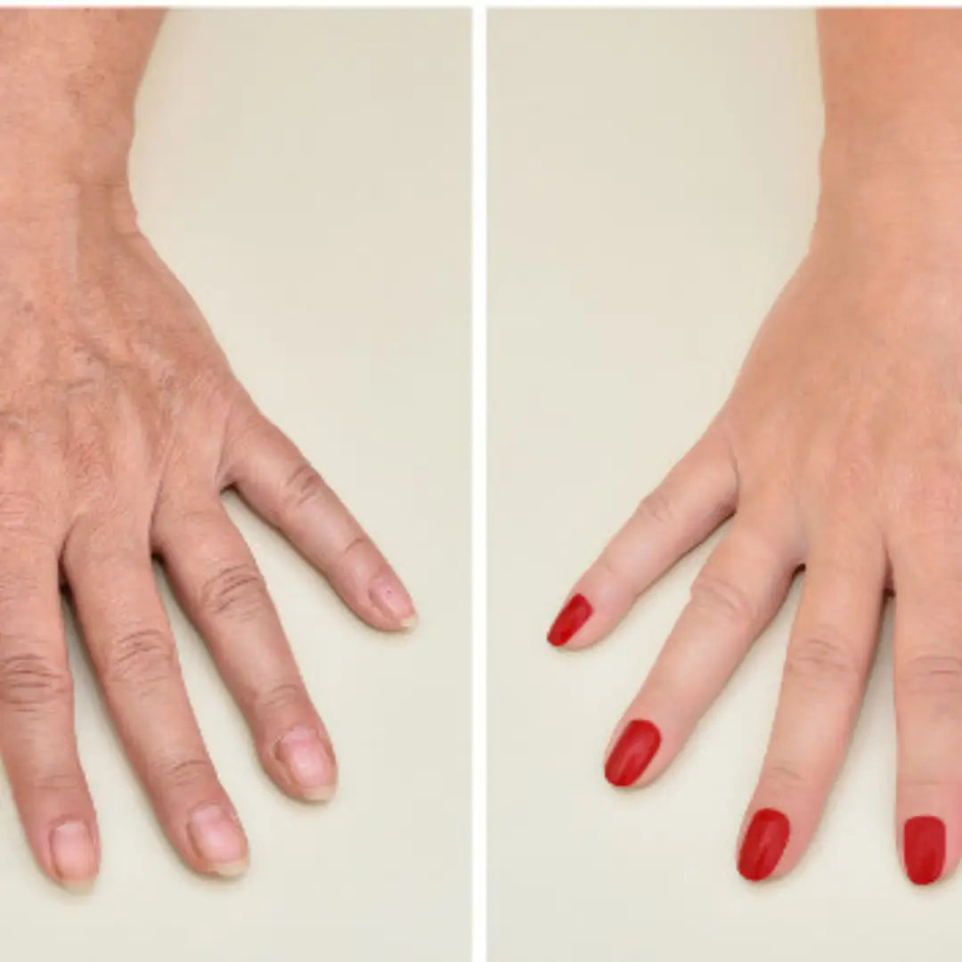 How to Rejuvenate Old and Mature-Looking Hands with Exercise